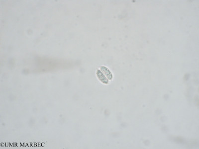 phyto/Mayotte/combani/Retenues_collinaires_de_Mayotte  2006-2009/Staurodesmus sp1 (x1.5x40 70709)(copy)_thumb.jpg